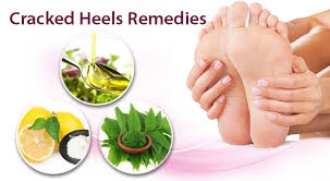  7 natural ways to treat cracked heels 