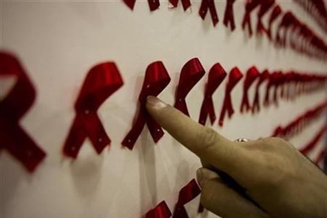  HIV also affects the brain, says study 