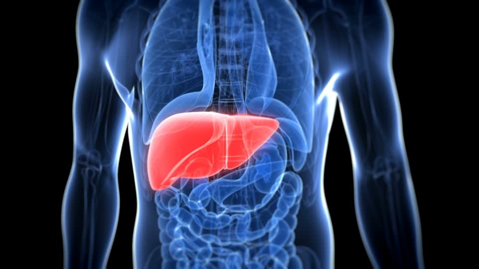 Non Alcoholic Fatty Liver Disease is a Life Threatening Lifestyle Disorder 