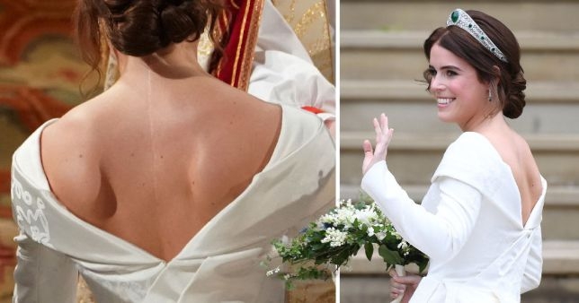 Princess Eugenie chose a backless dress to show her surgery scar and gave confidence to many who suffer from Scoliosis