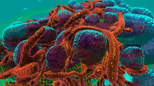  'Virtual tumour' model to offer new treatment against cancer 