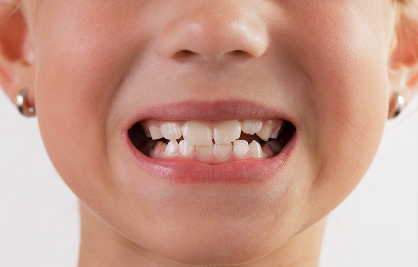  Does your dental floss contain toxic chemicals? 