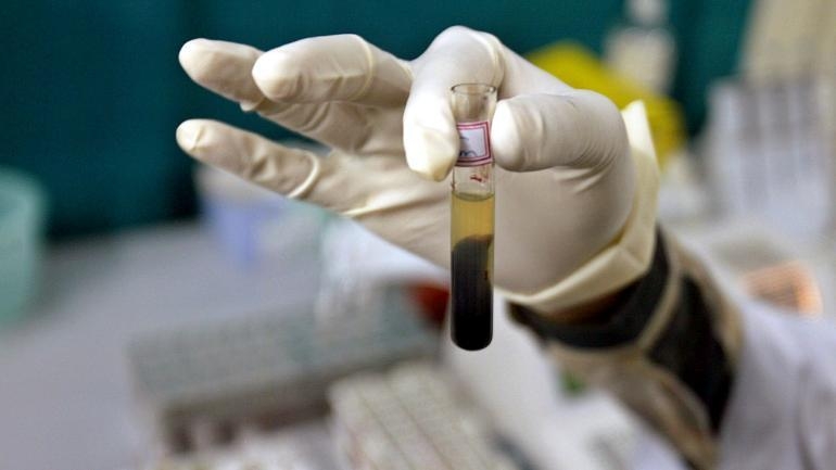 Blood transfusion gone wrong!