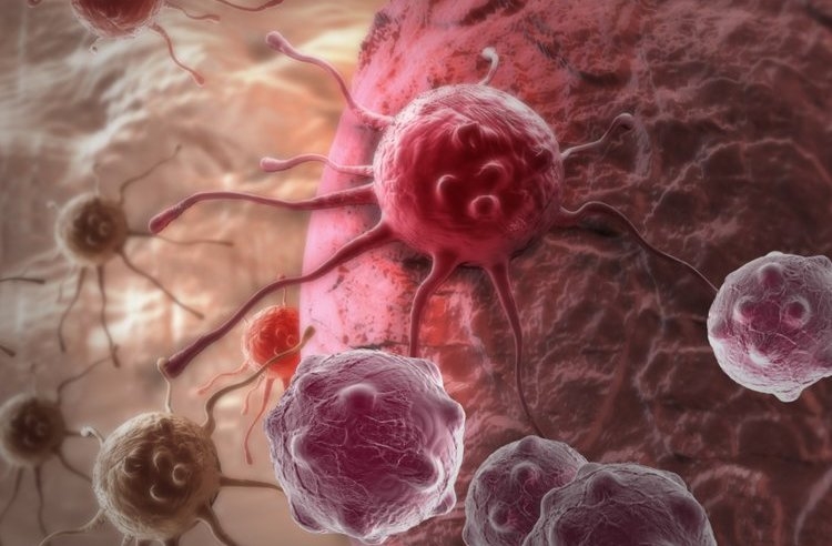 Awareness is the key to prevent cancer 