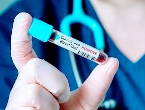 भारतीयों की ग़लती से ही भारत में बढ़ा कम्युनिटी ट्रांसमिशन का ख़तरा!