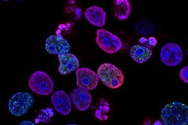  Gene delivery system shows promise in vision loss prevention 
