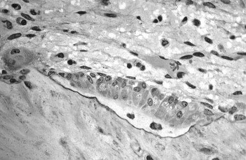  Yogurt consumption may improve bone health in elderly 