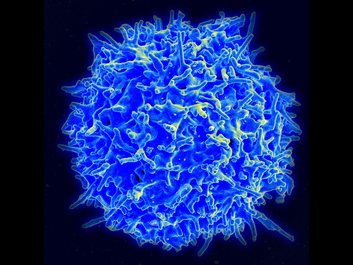  Scientists use light to attack cancer cells with immune system 
