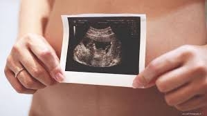  3-D printed ovaries may restore fertility in cancer survivors 