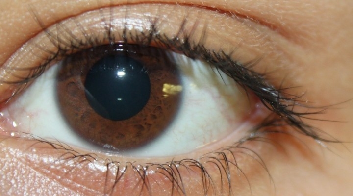  A low-glycemic diet may prevent age-related eye disease 