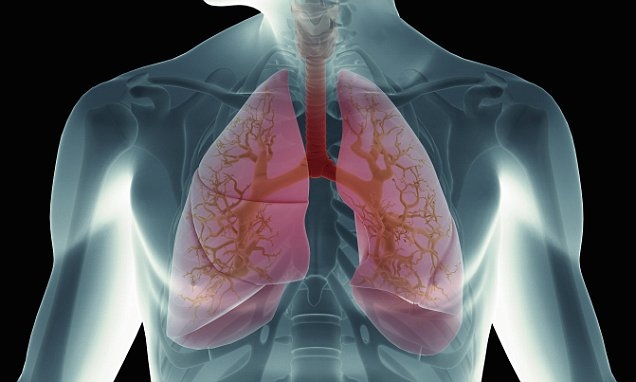  Lung cancer ups suicide risk in men: Study 