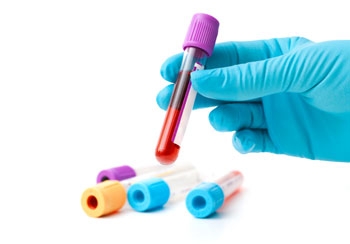  New blood test can predict onset of Huntington s disease 