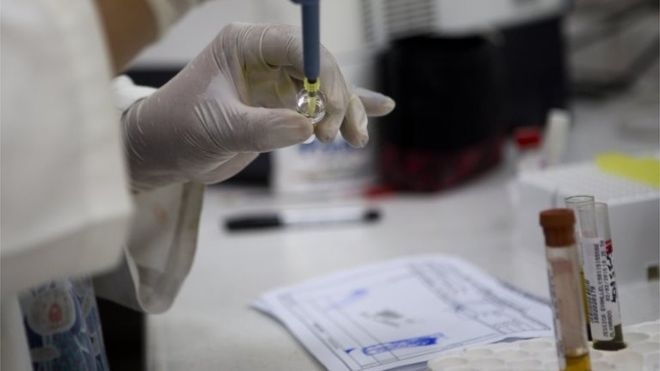  Six US pregnant women test positive for Zika 