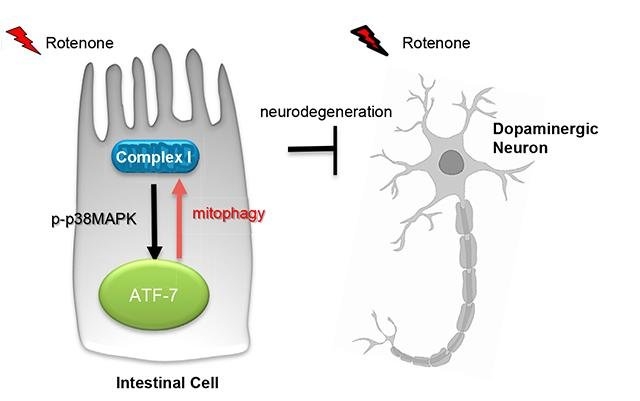  Parkinson s begins in gut cells: Study 