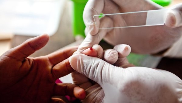  Researchers develop rapid blood test for malaria diagnosis 