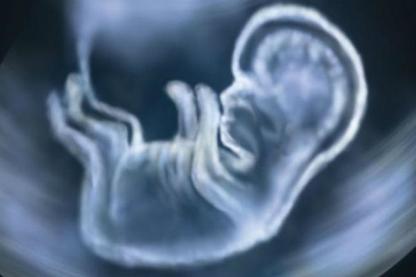  5-month-old foetus found alive after doctors declare it stillborn 