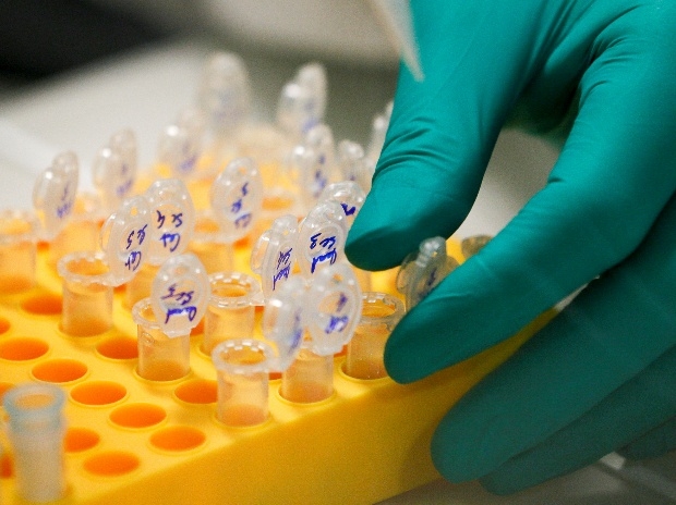  New 3-in-1 blood test to aid precision prostate cancer therapy 