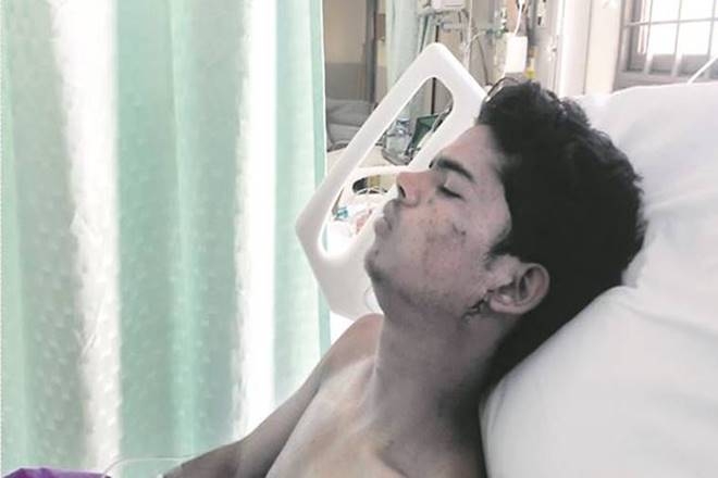  Slain Junaid s brother shifted to Apollo Hospital 