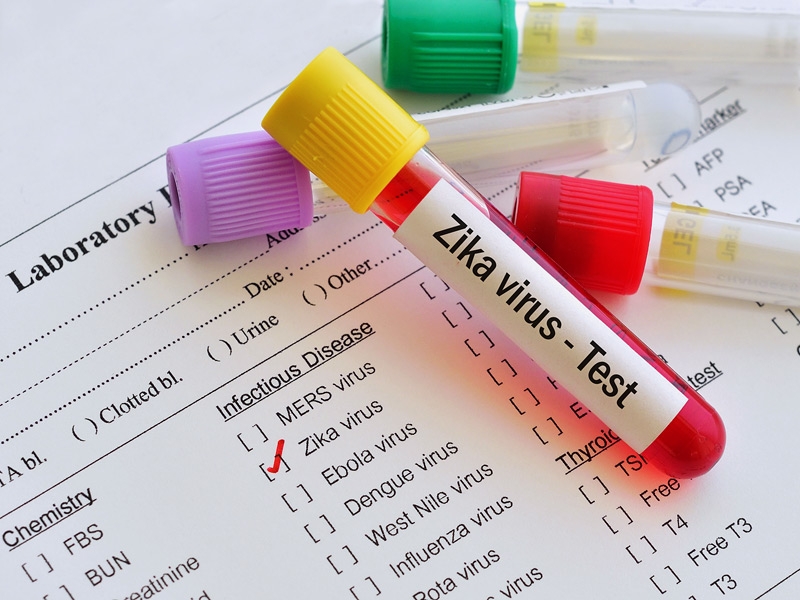  Antibody-based test may differentiate Zika from other infections 
