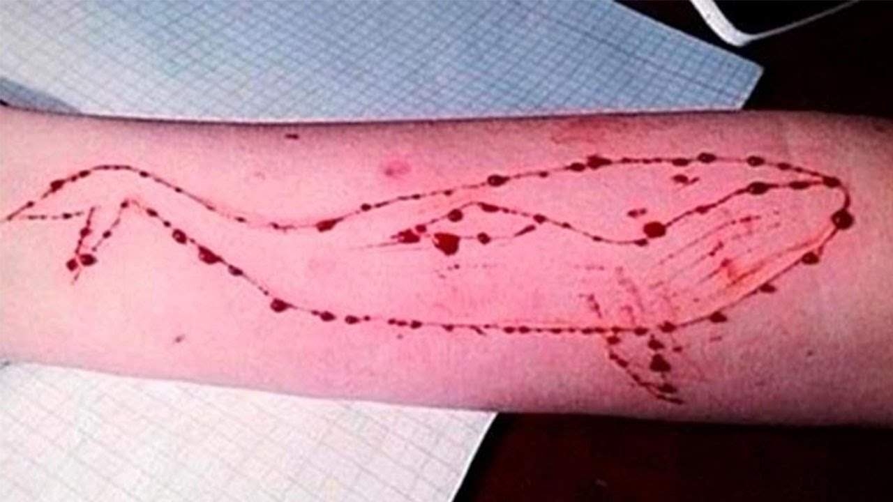  Bengal teenager hospitalised after playing Blue Whale Challenge 