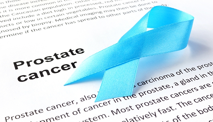  Prostate cancer rising in rural India, say experts 